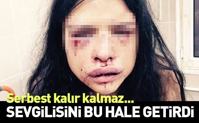 Onur Özbizerdik sevgilisini hastanelik etti