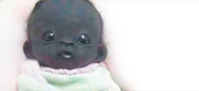Dünyanın en siyah bebeğinin sırrı çözüldü