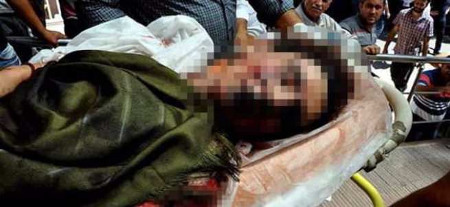 Genç kızın karnında bomba pimi bulundu