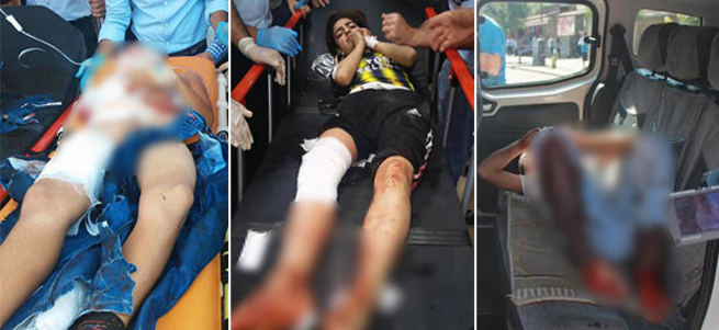 Diyarbakır'da patlama: 2'si ağır 5 çocuk yaralı