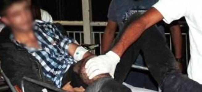 İzne gelen asker polise molotof atarken yaralandı