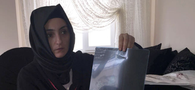 Ameliyat olan kadının karnında mala unuttular