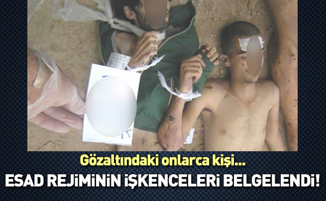 HRW'den, Suriye'de Ölülerin dili olsa raporu