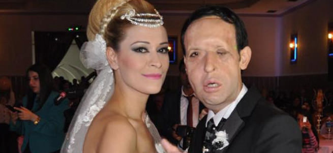 Recep Sert baba olmaya hazırlanıyor