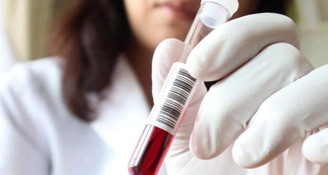 H1N1 hortladı