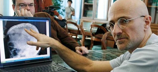 Dr. Canavero maymuna kafa nakli yaptı