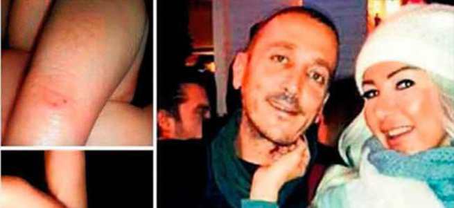 Medyatik güzelden sevgiliye şiddet davası