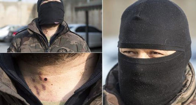 Yaralanan özel harekat polisi çatışmaya geri döndü