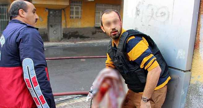 Bağlar'da polis yaralı halde silahı bırakmadı!
