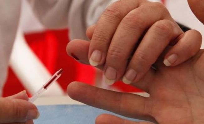 Bilim insanları açıkladı: AIDS'i alt ettik!